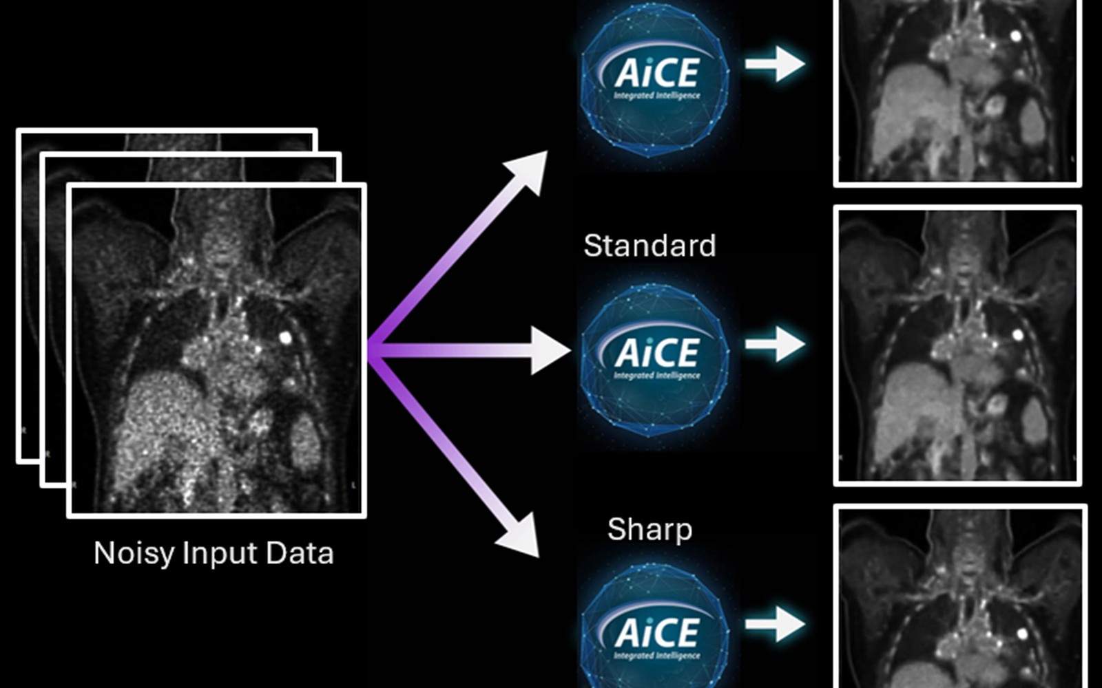 Canon Medical CT Scanner Financing
