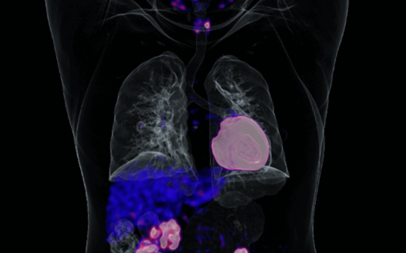 United Imaging CT Scanner Financing