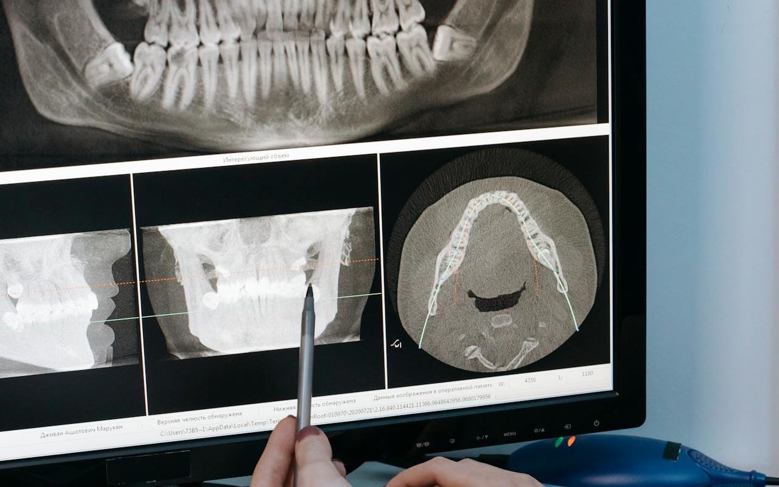 Cone-Beam CT (CBCT) Scanner Financing
