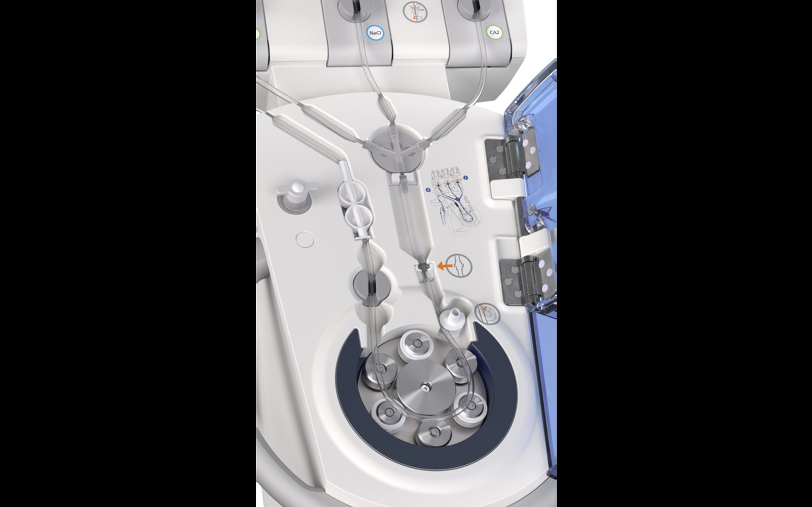 CT Contrast Injector System Financing