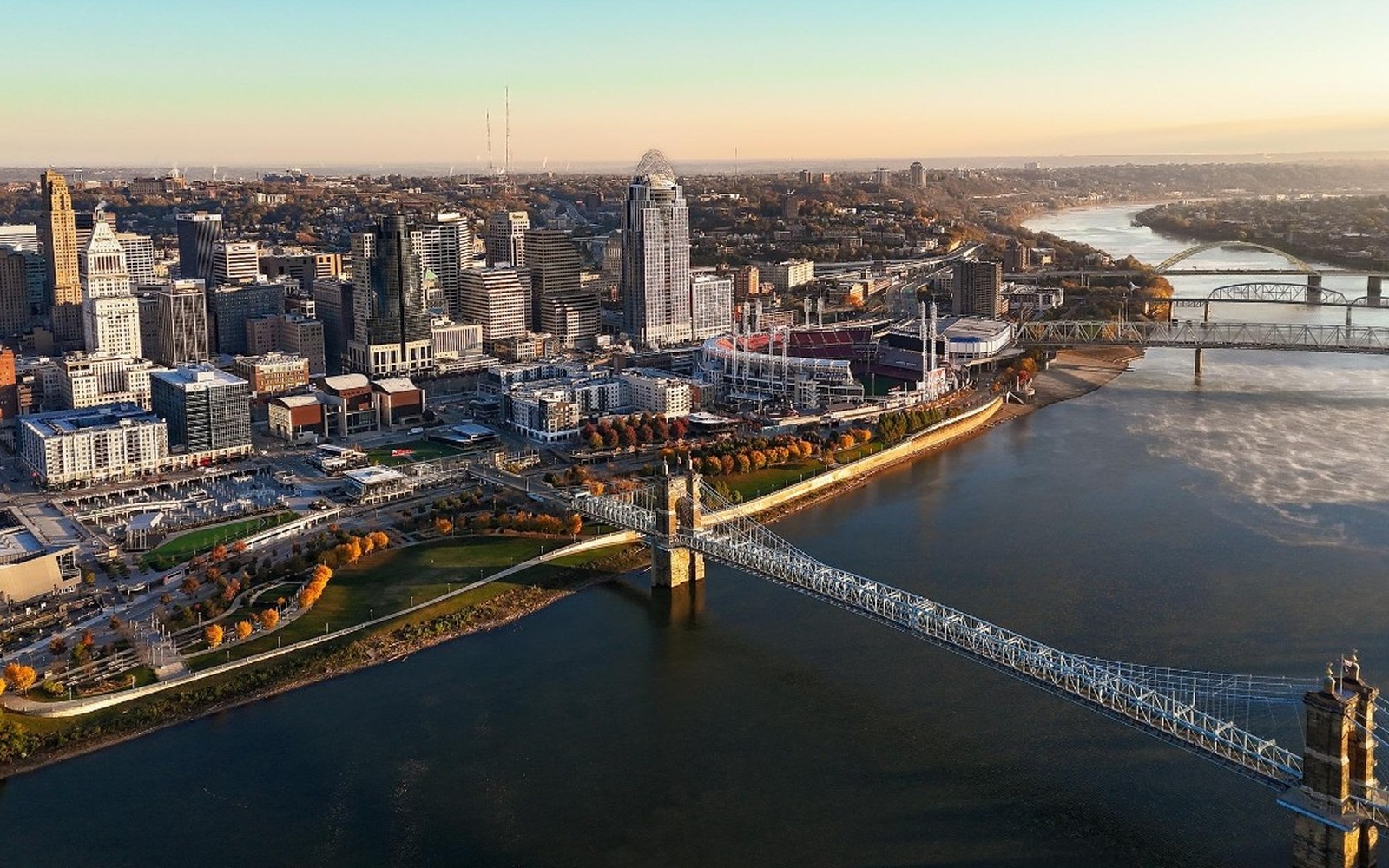CT Scanner Financing in Cincinnati, OH